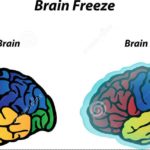 ব্রেইন ফ্রীজ